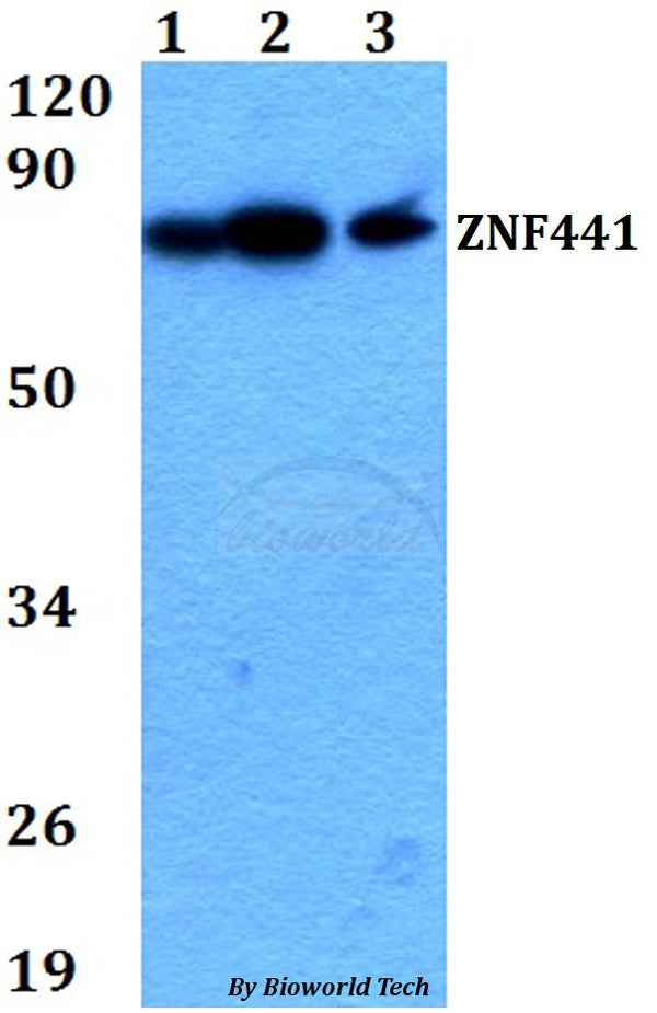 Western blot (WB) analysis of ZNF441 polyclonal antibody at 1:500 dilution
Lane1:HEK293T whole cell lysate
Lane2:A549 whole cell lysate 
Lane3:PC12 whole cell lysate