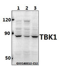 Western blot (WB) analysis of TBK1 polyclonal antibody at 1:500 dilution
Lane1:SK-OVCAR3 whole cell lysate(40ug)
Lane2:HCT116 whole cell lysate(40ug)
Lane3:CT26 whole cell lysate(40ug)