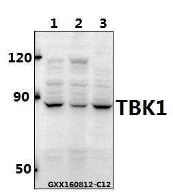 Western blot (WB) analysis of TBK1 polyclonal antibody at 1:500 dilution
Lane1:SK-OVCAR3 whole cell lysate(40ug)
Lane2:HCT116 whole cell lysate(40ug)
Lane3:CT26 whole cell lysate(40ug)