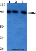 Western blot (WB) analysis of EMR2 polyclonal antibody at 1:500 dilution
Lane1:HEK293T whole cell lysate
Lane2:Raw264.7 whole cell lysate 
Lane3:PC12 whole cell lysate