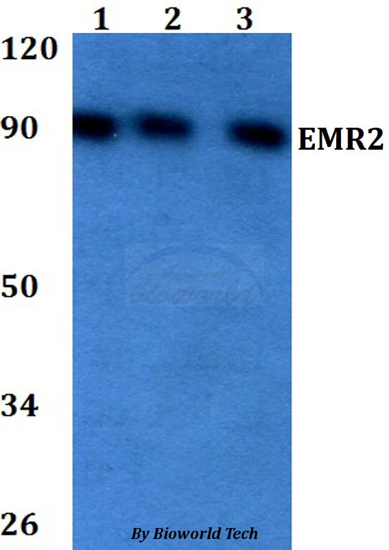 Western blot (WB) analysis of EMR2 polyclonal antibody at 1:500 dilution
Lane1:HEK293T whole cell lysate
Lane2:Raw264.7 whole cell lysate 
Lane3:PC12 whole cell lysate