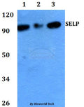 Western blot (WB) analysis of SELP polyclonal antibody at 1:500 dilution
Lane1:HEK293T whole cell lysate
Lane2:Raw264.7 whole cell lysate 
Lane3:PC12 whole cell lysate