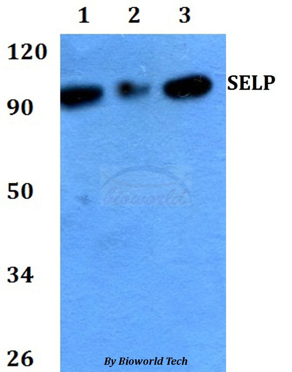 Western blot (WB) analysis of SELP polyclonal antibody at 1:500 dilution
Lane1:HEK293T whole cell lysate
Lane2:Raw264.7 whole cell lysate 
Lane3:PC12 whole cell lysate