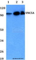 Western blot (WB) analysis of UNC5A polyclonal antibody at 1:500 dilution
Lane1:HEK293T whole cell lysate
Lane2:Raw264.7 whole cell lysate 
Lane3:PC12 whole cell lysate