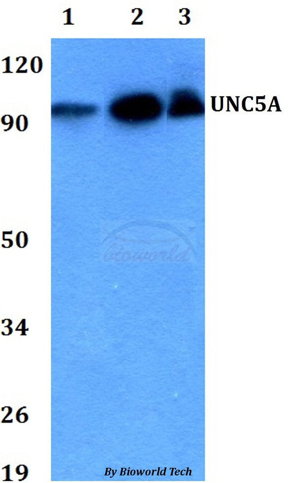 Western blot (WB) analysis of UNC5A polyclonal antibody at 1:500 dilution
Lane1:HEK293T whole cell lysate
Lane2:Raw264.7 whole cell lysate 
Lane3:PC12 whole cell lysate