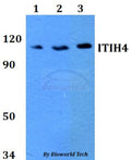 Western blot (WB) analysis of ITIH4 polyclonal antibody at 1:500 dilution
Lane1:HEK293T whole cell lysate
Lane2:Raw264.7 whole cell lysate 
Lane3:PC12 whole cell lysate