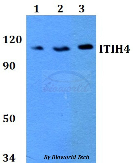 Western blot (WB) analysis of ITIH4 polyclonal antibody at 1:500 dilution
Lane1:HEK293T whole cell lysate
Lane2:Raw264.7 whole cell lysate 
Lane3:PC12 whole cell lysate