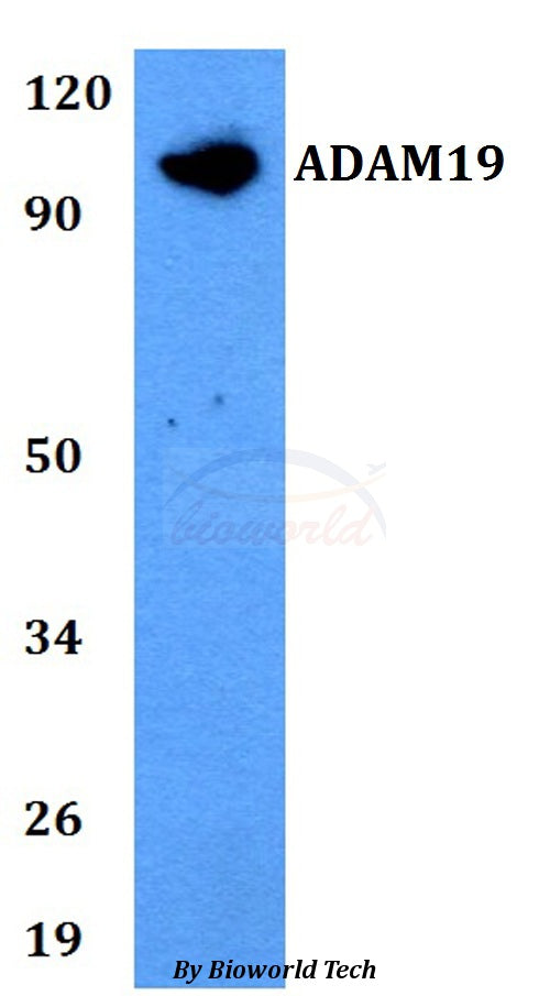 Western blot (WB) analysis of ADAM19 polyclonal antibody at 1:500 dilution
Lane1:MCF-7 whole cell lysate