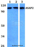 Western blot (WB) analysis of ASAP2 polyclonal antibody at 1:500 dilution
Lane1:HEK293T whole cell lysate
Lane2:sp2/0 whole cell lysate 
Lane3:H9C2 whole cell lysate