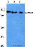 APOBR polyclonal antibody – Figure 1 of 2