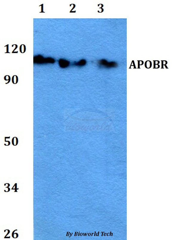APOBR polyclonal antibody – Figure 1 of 2