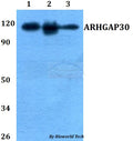ARHGAP30 polyclonal antibody – Figure 1 of 1