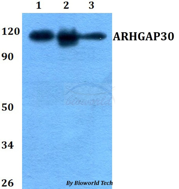 ARHGAP30 polyclonal antibody – Figure 1 of 1