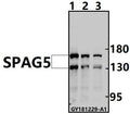 Western blot (WB) analysis of SPAG5 pAb at 1:500 dilution
Lane1:Myla2059 whole cell lysate(40ug)
Lane2:HEK293T whole cell lysate(40ug)
Lane3:HuT78 whole cell lysate(40ug)