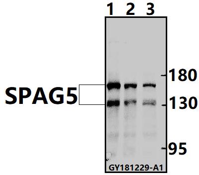 Western blot (WB) analysis of SPAG5 pAb at 1:500 dilution
Lane1:Myla2059 whole cell lysate(40ug)
Lane2:HEK293T whole cell lysate(40ug)
Lane3:HuT78 whole cell lysate(40ug)