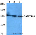 Western blot (WB) analysis of ADAMTS18 polyclonal antibody at 1:500 dilution
Lane1:HEK293T whole cell lysate
Lane2:Raw264.7 whole cell lysate 
Lane3:PC12 whole cell lysate
