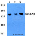 COL5A2 polyclonal antibody – Figure 1 of 1