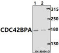 Western blot (WB) analysis of CDC42BPA pAb at 1:500 dilution
Lane1:Panc1 whole cell lysate(40ug)
Lane2: U-87MG whole cell lysate(40ug)