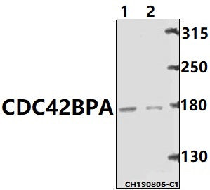 Western blot (WB) analysis of CDC42BPA pAb at 1:500 dilution
Lane1:Panc1 whole cell lysate(40ug)
Lane2: U-87MG whole cell lysate(40ug)