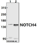 Western blot (WB) analysis of NOTCH4 pAb at 1:500 dilution
Lane1:A549 whole cell lysate(40ug)
Lane2:HepG2 whole cell lysate(40ug)