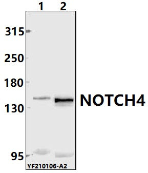 Western blot (WB) analysis of NOTCH4 pAb at 1:500 dilution
Lane1:A549 whole cell lysate(40ug)
Lane2:HepG2 whole cell lysate(40ug)