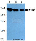 Western blot (WB) analysis of HEATR1 polyclonal antibody at 1:500 dilution
Lane1:HEK293T whole cell lysate
Lane2:sp2/0 whole cell lysate 
Lane3:PC12 whole cell lysate