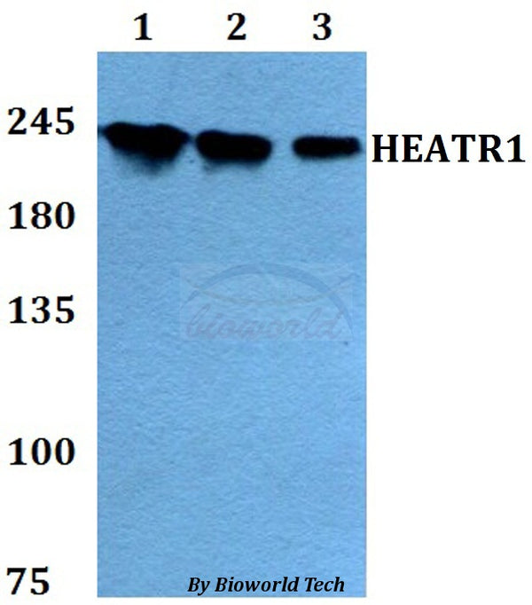 Western blot (WB) analysis of HEATR1 polyclonal antibody at 1:500 dilution
Lane1:HEK293T whole cell lysate
Lane2:sp2/0 whole cell lysate 
Lane3:PC12 whole cell lysate
