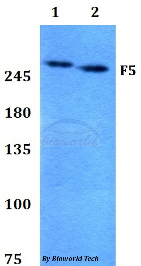Western blot (WB) analysis of F5 polyclonal antibody at 1:500 dilution
Lane1:HEK293T whole cell lysate
Lane2:PC12 whole cell lysate
