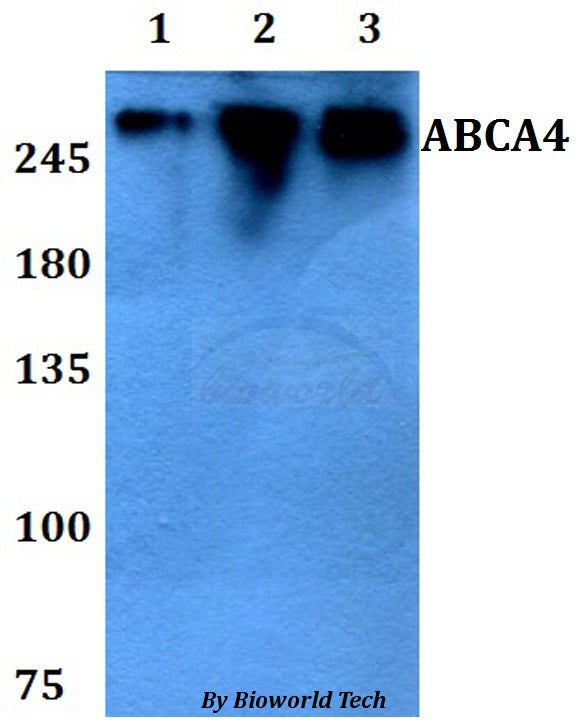 Western blot (WB) analysis of ABCA4 polyclonal antibody at 1:500 dilution
Lane1:HEK293T whole cell lysate
Lane2:sp2/0 whole cell lysate 
Lane3:PC12 whole cell lysate