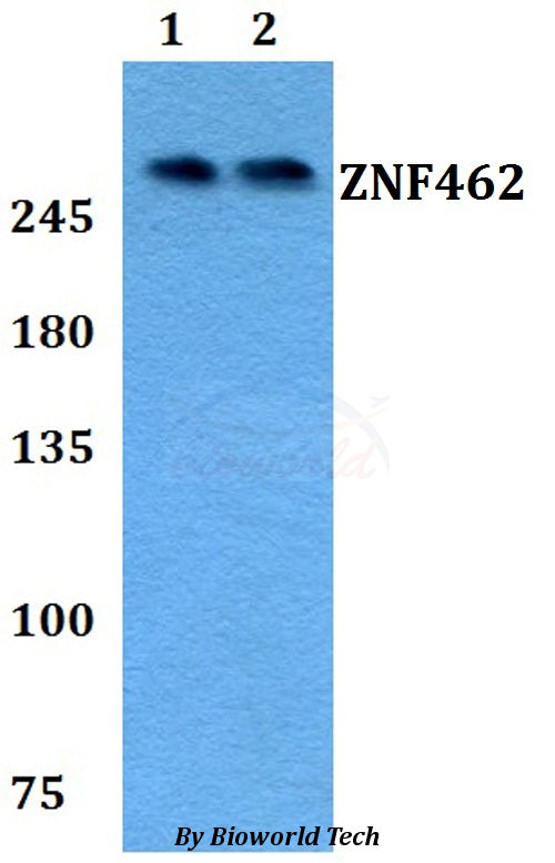 Western blot (WB) analysis of ZNF462 polyclonal antibody at 1:500 dilution
Lane1:A549 whole cell lysate
Lane2:PC12 whole cell lysate