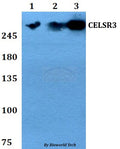 Western blot (WB) analysis of CELSR3 polyclonal antibody at 1:500 dilution
Lane1:HEK293T whole cell lysate
Lane2:sp2/0 whole cell lysate 
Lane3:PC12 whole cell lysate