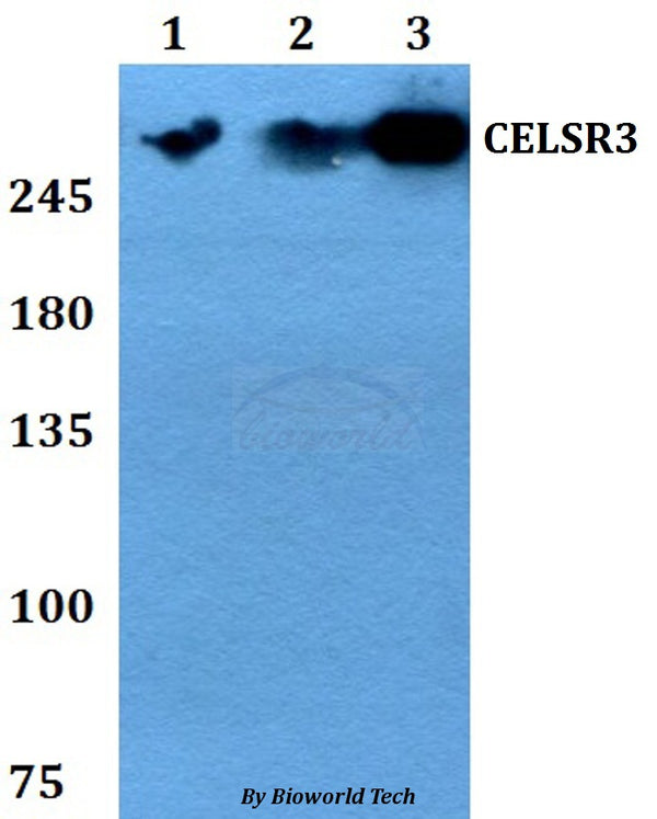 Western blot (WB) analysis of CELSR3 polyclonal antibody at 1:500 dilution
Lane1:HEK293T whole cell lysate
Lane2:sp2/0 whole cell lysate 
Lane3:PC12 whole cell lysate