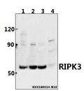 Western blot (WB) analysis of RIPK3 polyclonal antibody at 1:500 dilution
Lane1:Panc1 whole cell lysate(40ug)
Lane2:HEK293T whole cell lysate(40ug)
Lane3:CT26 whole cell lysate(40ug)
Lane4:PC12 whole cell lysate(40ug)