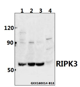 Western blot (WB) analysis of RIPK3 polyclonal antibody at 1:500 dilution
Lane1:Panc1 whole cell lysate(40ug)
Lane2:HEK293T whole cell lysate(40ug)
Lane3:CT26 whole cell lysate(40ug)
Lane4:PC12 whole cell lysate(40ug)