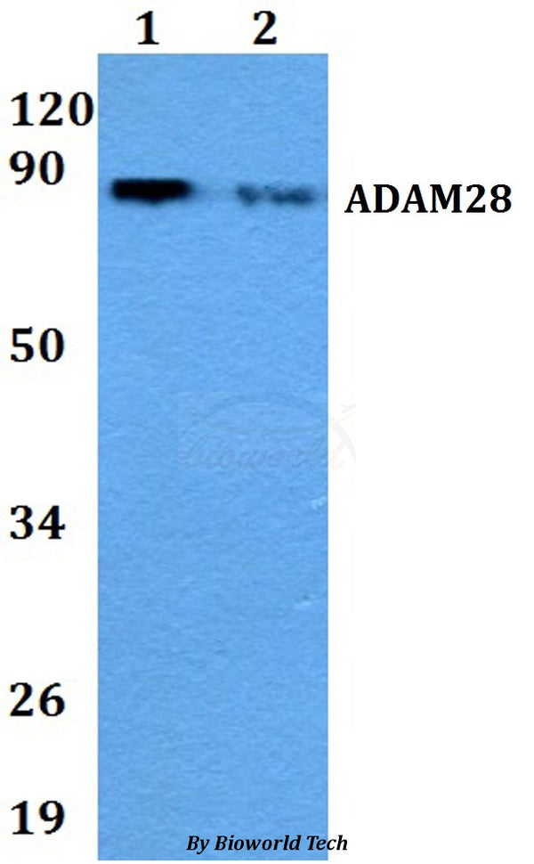 Western blot (WB) analysis of ADAM28 polyclonal antibody at 1:500 dilution
Lane1:A549 whole cell lysate
Lane2:Raw264.7 whole cell lysate