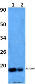 Western blot (WB) analysis of IL36RN polyclonal antibody at 1:500 dilution
Lane1:HEK293T whole cell lysate
Lane2:H9C2 whole cell lysate