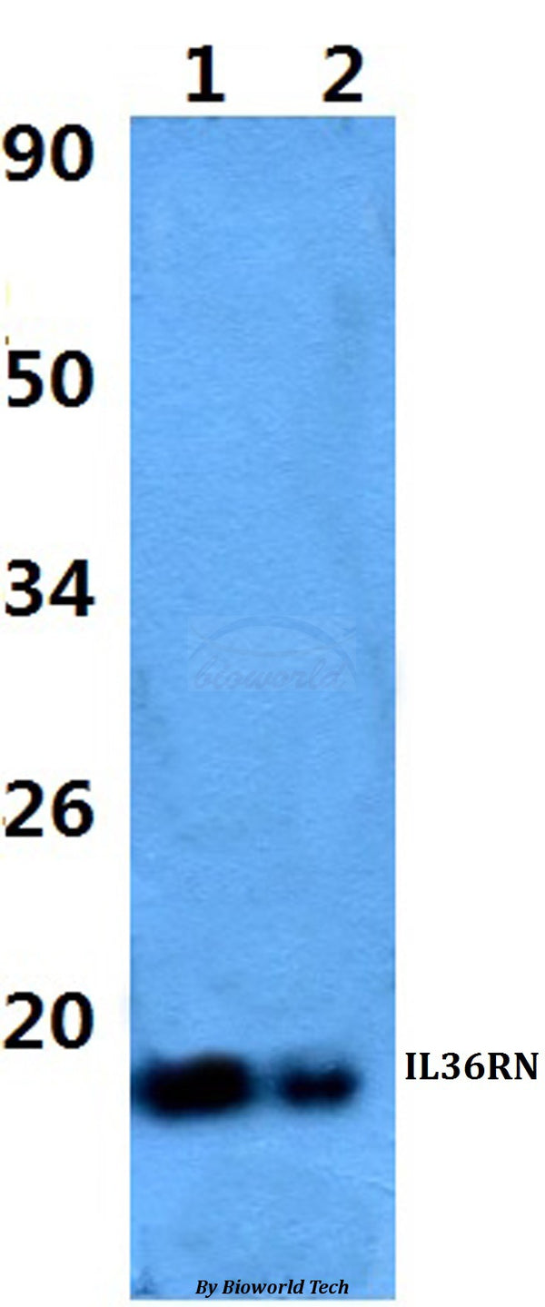 Western blot (WB) analysis of IL36RN polyclonal antibody at 1:500 dilution
Lane1:HEK293T whole cell lysate
Lane2:H9C2 whole cell lysate