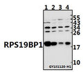 Western blot (WB) analysis of RPS19BP1 pAb at 1:500 dilution
Lane1:HCT116 whole cell lysate(40ug)
Lane2:H1792 whole cell lysate(40ug)
Lane3:EC9706 whole cell lysate(40ug)
Lane4:A549 whole cell lysate(40ug)
