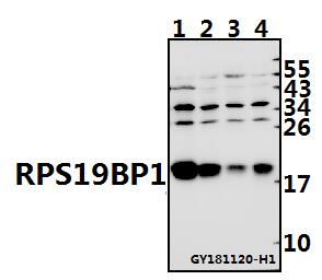 Western blot (WB) analysis of RPS19BP1 pAb at 1:500 dilution
Lane1:HCT116 whole cell lysate(40ug)
Lane2:H1792 whole cell lysate(40ug)
Lane3:EC9706 whole cell lysate(40ug)
Lane4:A549 whole cell lysate(40ug)