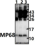 Western blot (WB) analysis of MP68 pAb at 1:1000 dilution
Lane1:The Brain tissue lysate of Rat(20ug)
Lane2:HepG2 whole cell lysate(20ug)
Lane3:HCT116 whole cell lysate(20ug)