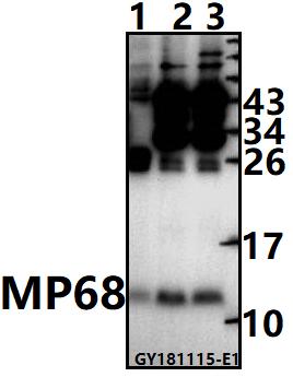 Western blot (WB) analysis of MP68 pAb at 1:1000 dilution
Lane1:The Brain tissue lysate of Rat(20ug)
Lane2:HepG2 whole cell lysate(20ug)
Lane3:HCT116 whole cell lysate(20ug)