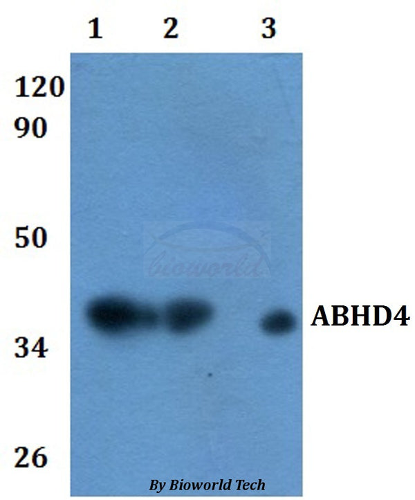 Western blot (WB) analysis of ABHD4 polyclonal antibody at 1:500 dilution  Lane1:HEK293T whole cell lysate
Lane2:RAW264.7 whole cell lysate  Lane3:H9C2 whole cell lysate