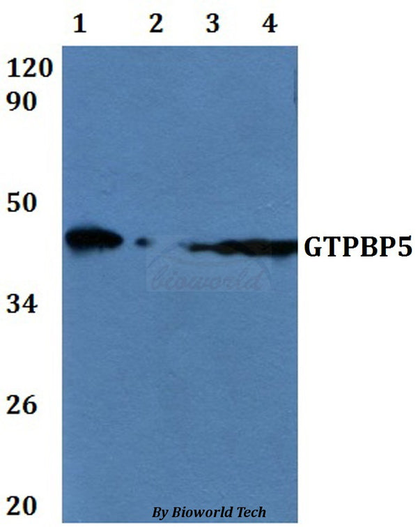 Western blot (WB) analysis of GTPBP5 polyclonal antibody at 1:500 dilution 
Line1:A549 whole cell lysate
Line2:Hela whole cell lysate
Line3:PC12 whole cell lysate
Line4:sp20 whole cell lysate