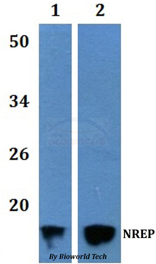 Western blot (WB) analysis of NREP polyclonal antibody at 1:500 dilution  Lane1:HEK293T whole cell lysate   Lane2:H9C2 whole cell lysate