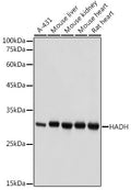 Western blot analysis of extracts of various cell lines, using HADH antibody  at 1:1000 dilution.
Secondary antibody: HRP Goat Anti-Rabbit IgG   at 1:10000 dilution.
Lysates/proteins: 25ug per lane.
Blocking buffer: 3% nonfat dry milk in TBST.
Detection: ECL Basic Kit .
Exposure time: 1s.
