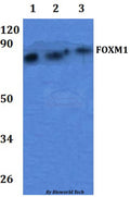 Western blot (WB) analysis of FOXM1pAb at 1:500 dilution
Lane1:OVCAR3 whole cell lysate
Lane2:Raw264.7 whole cell lysate
Lane3:H9C2 whole cell lysate