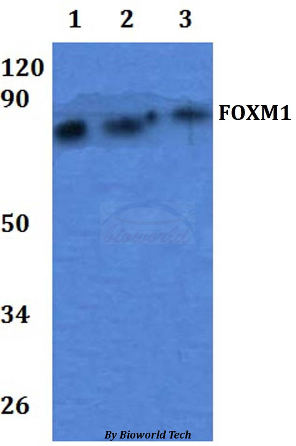Western blot (WB) analysis of FOXM1pAb at 1:500 dilution
Lane1:OVCAR3 whole cell lysate
Lane2:Raw264.7 whole cell lysate
Lane3:H9C2 whole cell lysate