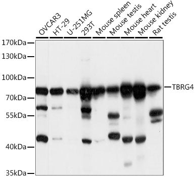 Western blot analysis of extracts of various cell lines, using TBRG4 antibody  at 1:1000 dilution.
Secondary antibody: HRP Goat Anti-Rabbit IgG   at 1:10000 dilution.
Lysates/proteins: 25ug per lane.
Blocking buffer: 3% nonfat dry milk in TBST.
Detection: ECL Basic Kit .
Exposure time: 1s.