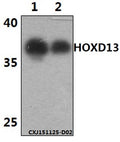 Western blot (WB) analysis of HOXD13 polyclonal antibody at 1:500 dilution
Lane1:The brain tissue lysate of Mouse(30ug)
Lane2:The brain tissue lysate of Rat(30ug)