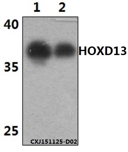 Western blot (WB) analysis of HOXD13 polyclonal antibody at 1:500 dilution
Lane1:The brain tissue lysate of Mouse(30ug)
Lane2:The brain tissue lysate of Rat(30ug)